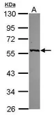 Anti-GPT antibody [N2C2], Internal used in Western Blot (WB). GTX112952