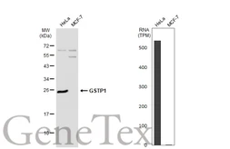 Anti-GSTP1 antibody used in Western Blot (WB). GTX112953