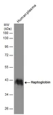 Anti-Haptoglobin antibody used in Western Blot (WB). GTX112962