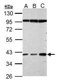 Anti-Haptoglobin antibody used in Western Blot (WB). GTX112962