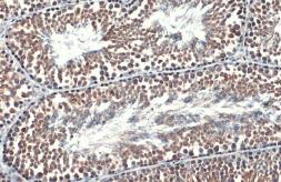 Anti-Hsp70 antibody used in IHC (Paraffin sections) (IHC-P). GTX112963