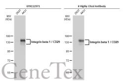 Anti-Integrin beta 1 / CD29 antibody used in Western Blot (WB). GTX112971