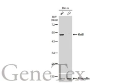 Anti-Cytokeratin 8 antibody [N1C1] used in Western Blot (WB). GTX112975