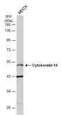 Anti-Cytokeratin 14 antibody [N3C3] used in Western Blot (WB). GTX112976