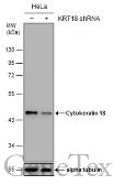 Anti-Cytokeratin 18 antibody [N3C3] used in Western Blot (WB). GTX112978