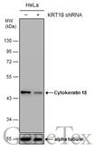 Anti-Cytokeratin 18 antibody [N3C3] used in Western Blot (WB). GTX112978