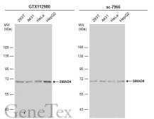 Anti-SMAD4 antibody used in Western Blot (WB). GTX112980