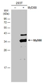 Anti-MyD88 antibody used in Western Blot (WB). GTX112987