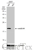 Anti-nm23-H1 antibody [N1C3] used in Western Blot (WB). GTX112988