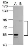 Anti-PI3 kinase p85 alpha antibody [C2C3], C-term used in Western Blot (WB). GTX112995
