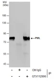 Anti-PML antibody [N1N2], N-term used in Immunoprecipitation (IP). GTX112996