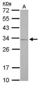 Anti-RPA32 antibody used in Western Blot (WB). GTX113004