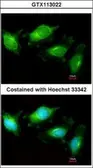 Anti-TLR3 antibody used in Immunocytochemistry/ Immunofluorescence (ICC/IF). GTX113022