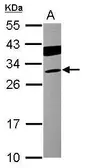 Anti-Cardiac Troponin I antibody [N1C3-3] used in Western Blot (WB). GTX113028