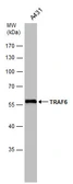 Anti-TRAF6 antibody [N2C2], Internal used in Western Blot (WB). GTX113029