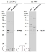 Anti-TRADD antibody [N2C3] used in Western Blot (WB). GTX113042