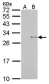 Anti-TRAIL antibody used in Western Blot (WB). GTX113043