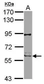 Anti-RIP2 antibody used in Western Blot (WB). GTX113044