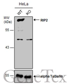 Anti-RIP2 antibody [C1C3] used in Western Blot (WB). GTX113045