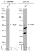 Anti-FLIP antibody [N1C1] used in Western Blot (WB). GTX113047