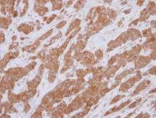 Anti-BCL10 antibody used in IHC (Paraffin sections) (IHC-P). GTX113048