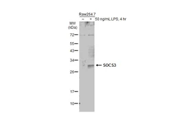 Anti-SOCS3 antibody [N1C3] used in Western Blot (WB). GTX113049