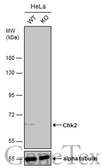 Anti-Chk2 antibody used in Western Blot (WB). GTX113055