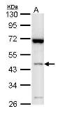 Anti-Bif-1 antibody [N3C3] used in Western Blot (WB). GTX113061