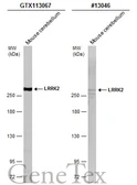 Anti-LRRK2 antibody [N3], Internal used in Western Blot (WB). GTX113067