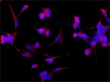 Anti-beta Tubulin antibody [D66] used in Immunocytochemistry/ Immunofluorescence (ICC/IF). GTX11307
