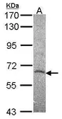 Anti-HDAC2 antibody used in Western Blot (WB). GTX113086