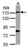 Anti-CD11b antibody [N1N2], N-term used in Western Blot (WB). GTX113089