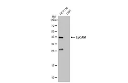 Anti-EpCAM antibody [N3C3] used in Western Blot (WB). GTX113091