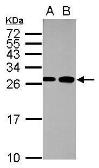 Anti-Fast skeletal myosin light chain 1 antibody used in Western Blot (WB). GTX113092
