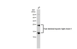 Anti-Fast skeletal myosin light chain 1 antibody used in Western Blot (WB). GTX113092