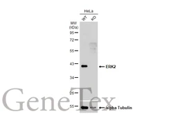 Anti-ERK2 antibody [N2C3] used in Western Blot (WB). GTX113094