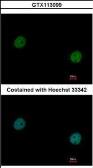 Anti-VCP antibody [N3C2], Internal used in Immunocytochemistry/ Immunofluorescence (ICC/IF). GTX113099