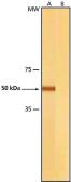 Anti-beta Tubulin antibody [2-28-33] used in Western Blot (WB). GTX11311