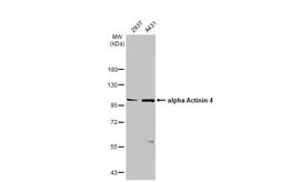 Anti-alpha Actinin 4 antibody [N2C1], Internal used in Western Blot (WB). GTX113115