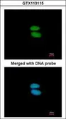 Anti-alpha Actinin 4 antibody [N2C1], Internal used in Immunocytochemistry/ Immunofluorescence (ICC/IF). GTX113115