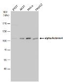 Anti-alpha Actinin 4 antibody [N1N2], N-term used in Western Blot (WB). GTX113116