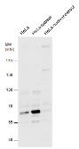 Anti-cIAP2 antibody [C1C3] used in Western Blot (WB). GTX113128