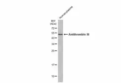 Anti-Antithrombin III antibody used in Western Blot (WB). GTX113132