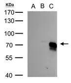 Anti-BMPR1A antibody used in Western Blot (WB). GTX113140