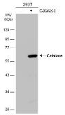 Anti-Catalase antibody [N2C1], Internal used in Western Blot (WB). GTX113149