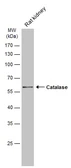 Anti-Catalase antibody [N2C1], Internal used in Western Blot (WB). GTX113149