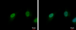 Anti-CDK6 antibody [N3C3] used in Immunocytochemistry/ Immunofluorescence (ICC/IF). GTX113159
