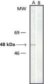 Anti-gamma Tubulin antibody [GTU-88] used in Western Blot (WB). GTX11316