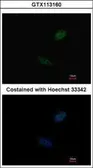 Anti-CDX2 antibody used in Immunocytochemistry/ Immunofluorescence (ICC/IF). GTX113160