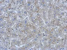 Anti-CD66e antibody [N1N3] used in IHC (Paraffin sections) (IHC-P). GTX113161